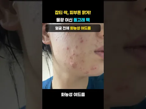 잡티 싹, 피부톤 맑게! 물광 여신 만드는 천연 '돌고래 팩'