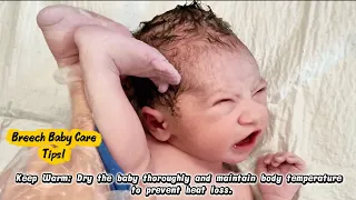 Head Last and  Feet-First Breech Baby | A Rare Newborn's First Moments
