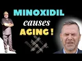 Minoxidil for Hair Loss Side Effects