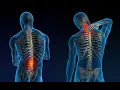 Channel