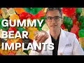 What are Gummy Bear Implants All About