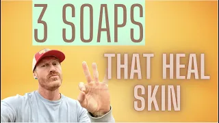 The 3 BEST natural SOAPS for Healing ECZEMA PSORIASIS DERMATITIS