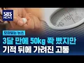 Download Lagu 3달 만에 50kg 쫙 뺐지만…기적 뒤에 가려진 고통 / SBS / 모아보는 뉴스