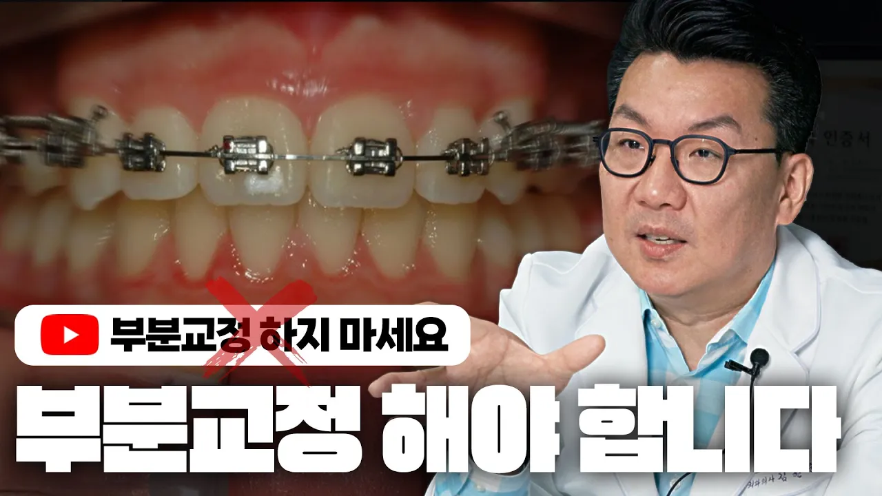 제가 좀 덜 벌면 됩니다.여러분 부분 교정 하셔도 정말 괜찮아요 [앞니 부분교정]