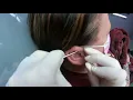 Double forward helix for Penny