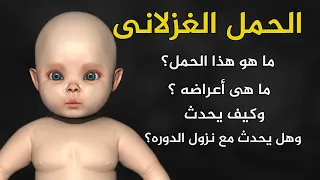 الحمل الغزلانى الاسباب والاعراض وهل يحدث الحمل مع نزول الدوره الشهريه 