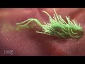Macrophage in action vs E coli MOA Animation of Phagocytosis a fundamental immunological process