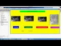 Design and analysis performance of Kidney Stone in Matlab