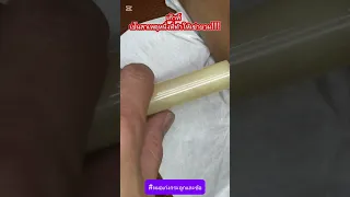  ทำไมถึงต้องตรวจระดับยูริกในร่างกาย เมื่อพบผลึกสีขาวในข้อเข่า 