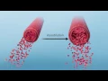 Blood Flow Vascular Resistance
