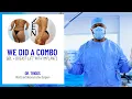 BBL Breast Lift Combo Dr Triggs Patient s Jaw-Dropping Transformation