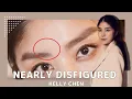 Lagu (Accident) Kelly Chen Was Nearly Disfigured In A Car Accident - Surprised To See Scar