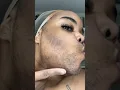 face wax with me using tresswellness