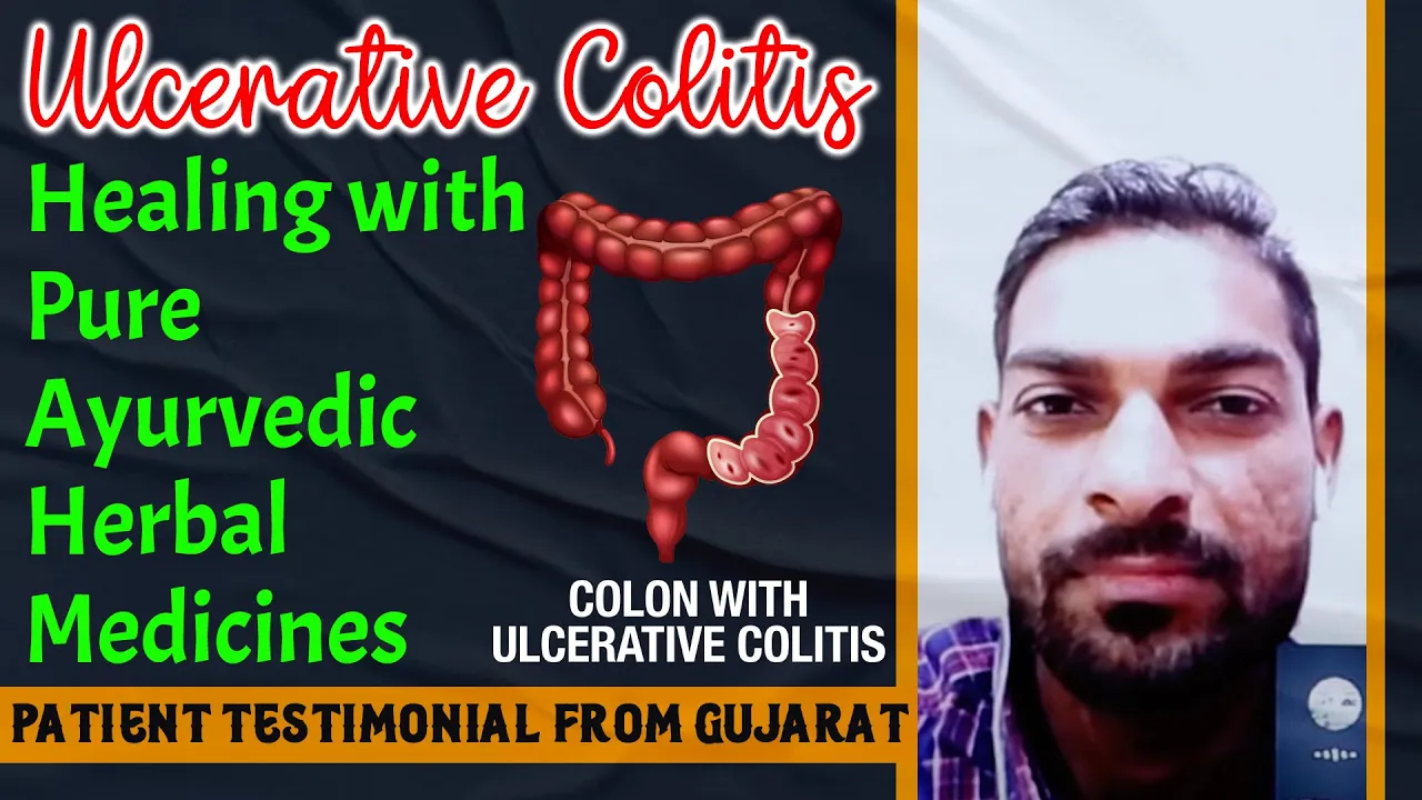 Watch Video Ulcerative Colitis Healing with Pure Ayurvedic Herbal Medicines - Patient Testimonial from Gujarat