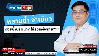 จ้ำเขียวที่เกิดขึ้นโดยไม่ได้ชนหรือกระแทกมีสาเหตุมาจากอะไรบ้าง