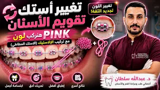 غيرنا لون التقويم لـ PINK 💗 وتركيب الإلاستيك المطاطي | Braces Color Change & Orthodontic Elastics