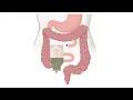 Closure of Enterostomy CPT code - simplify medical coding