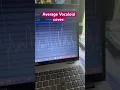 Perfectly normal Vocaloid tuning #vocaloid #cover #shortvideo