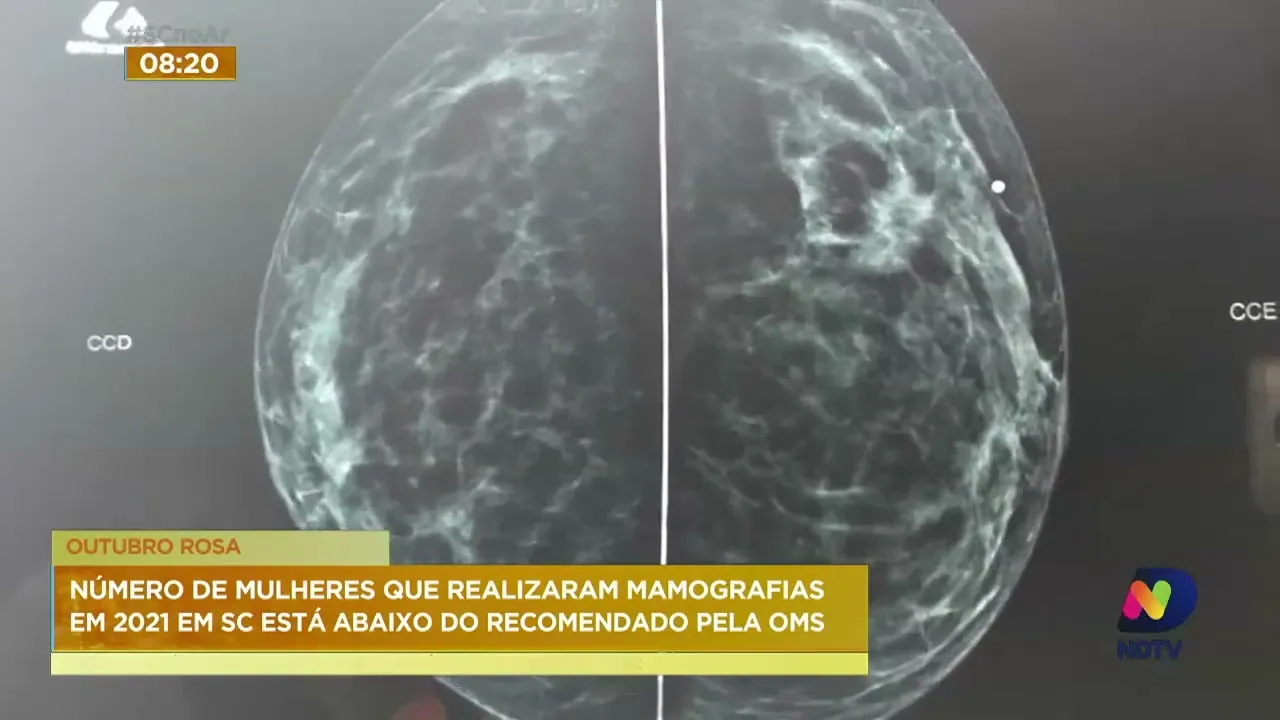 Exames de mamografias tem baixa procura em SC