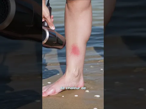 Piqûres de Méduses: Ce Qu'il Faut Faire VRAIMENT! 💦​🪼​