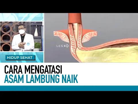 Begini! Penyebab dan Cara Atasi Asam Lambung Saat Naik | Tips Sehat
