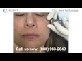 Microdermabrasion in New Jersey Princeton s Luxury Medspa