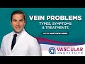 Understanding Varicose Veins Causes Symptoms Treatment with Matthew Soos NP