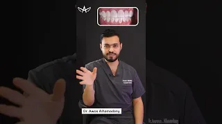 ابتسامة المشاهير انواعها وشنو الافضل  ابتسامة المشاهير انواعها وشنو الافضل