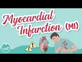 Myocardial Infarction MI Overview Med-Surg Nursing School Pathology Signs Symptoms