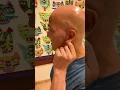 30 Second Acupressure Point STOPS Your Addictive Food Cravings Dr Mandell