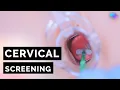 Cervical Screening Smear HPV OSCE Guide UKMLA CPSA PLAB 2
