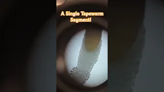 Tapeworm Eggs Galore A tapeworm Proglottid contains over 30k eggs