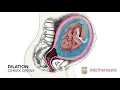 Effacement and Dilation