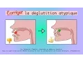Download Lagu Corriger la déglutition atypique