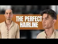 M159 Hair System Transformation Natural Hairline Breathable Lace