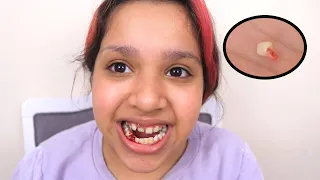 شفا خلعت سنها  بنفسها     دندنها