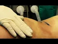 Miami Doctor Banned From Doing Brazilian Butt Lifts
