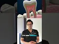 How to Reverse Tooth Decay