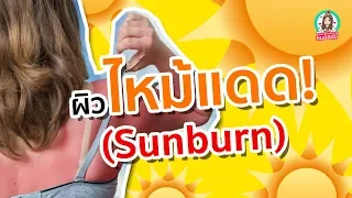 เมื่อผิวไหม้แดด ควรดูแลตัวเองอย่างไรบ้าง
