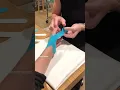 Taping technique for metacarpal phalangeal joint thumb injury