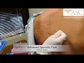 Allergy Testing at Advanced Specialty Care