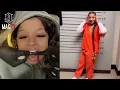 I Got My Tooth Back Chrisean Rock Gets Lost Tooth Replaced Before Visiting Kai Cenat In Jail