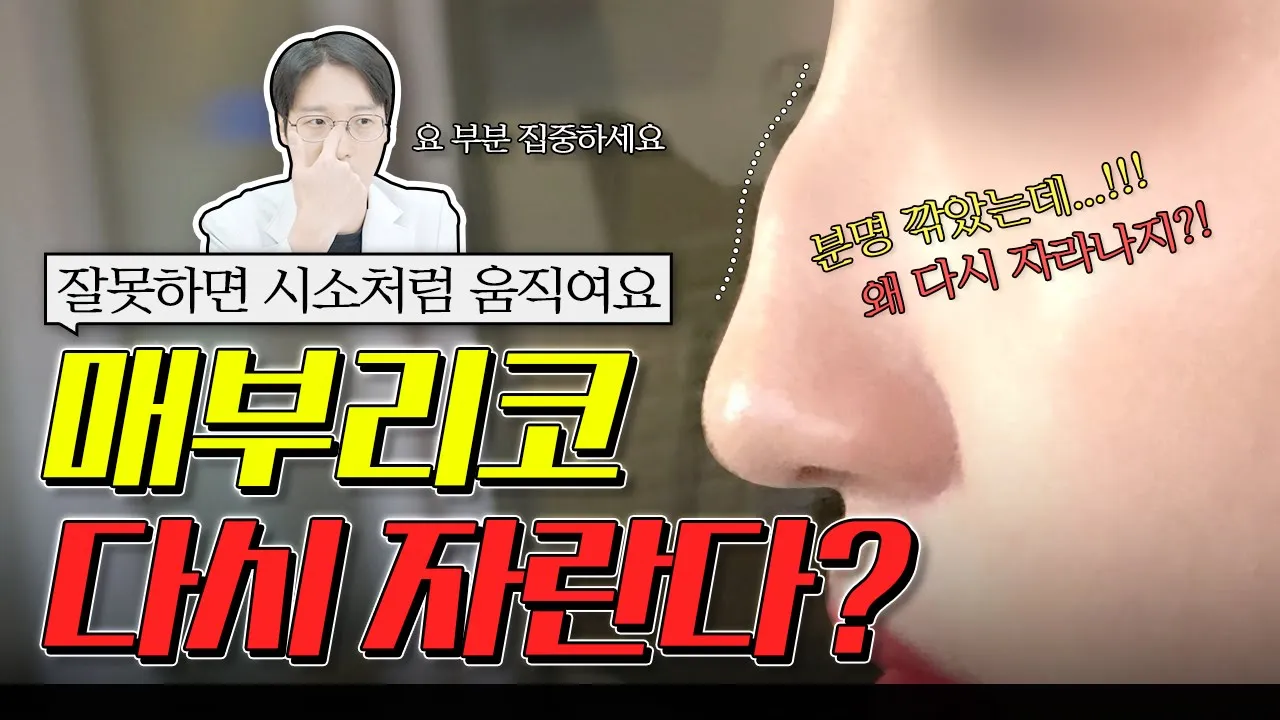[코성형] 분명 깎았는데!! 매부리 제거해도 다시 자란다면? 해결 방법은... (feat. 시소처럼 움직이는 매부리코)