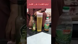 كيفية القضاء على القمل وبيضه نهائيا 
