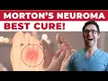 11 BEST Mortons Neuroma Massage Exercise Stretch Treatments WOW