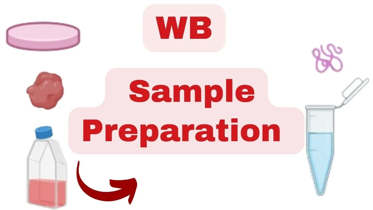 🛑 WESTERN BLOT MASTERY: Complete Guide to SAMPLE PREPARATION