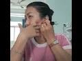 Ki thuat gach 6 vung he bach huyet
