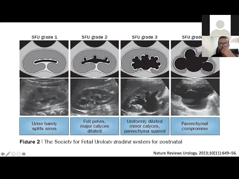 Download MP3 Ecografía renal y de vías urinarias