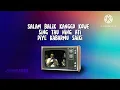 Download Lagu TAK LALEKNE KOWE - GILGA SYAHID Karaoke