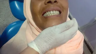 تركيب طقم اسنان متحرك لصاحبته 